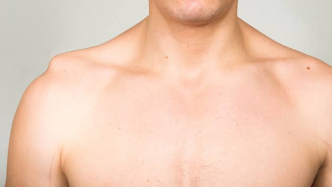 Shoulder split on sale